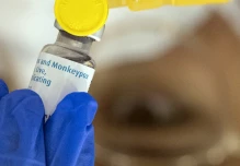 El primer caso de viruela del mono fuera de África fue detectado en Suecia