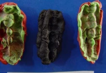 Hace 10.000 años, el hombre ya sufría de caries y enfermedades de las encías